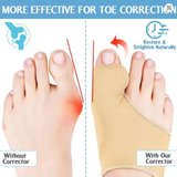Bunion Corrector Big Toe Splint Straightener Hallux Valgus Foot Separator Hammer